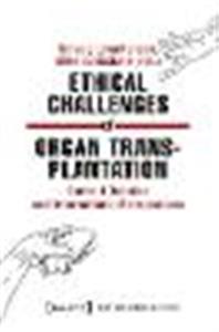 Ethical Challenges of Organ Transplantation: Current Debates and International Perspectives - Click Image to Close