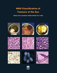 WHO Classification of Tumours of the Eye: WHO Classification of Tumours, Volume 12 WHO Classification of Tumours of the Eye: WHO Classification of Tumours, Volume 12