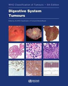 Digestive system tumours