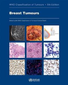 Breast Tumours - Click Image to Close