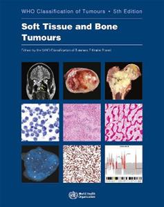 WHO classification of tumours of soft tissue and bone tumours Vol 3 WHO classification of tumours of soft tissue and bone tumours Vol 3