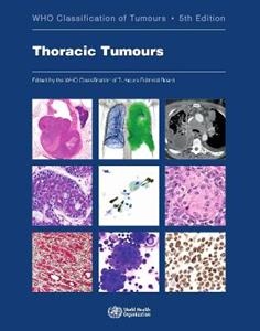 Thoracic tumours Vol 5