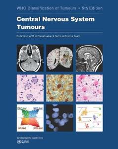 WHO classification of tumours of the central nervous system Vol 6