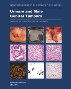 WHO classification of tumours of the urinary system and male genital organs Vol 8 WHO classification of tumours of the urinary system and male genital organs Vol 8