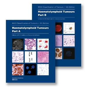 The WHO Classification of Tumours Haematolymphoid Tumours (Volume 11) 5th edition