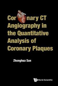 Coronary Ct Angiography In The Quantitative Analysis Of Coronary Plaques - Click Image to Close
