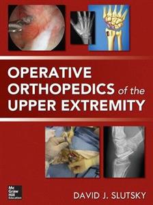 Operative Orthopedics of the Upper Extremity