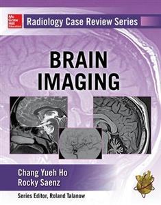 Radiology Case Review Series: Brain Imaging