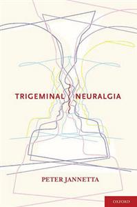 Trigeminal Neuralgia