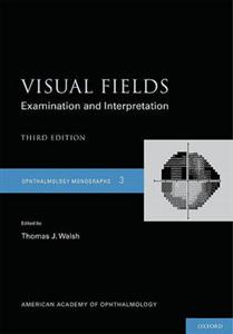 Visual Fields