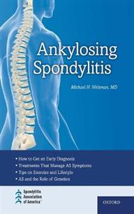 Ankylosing Spondylitis