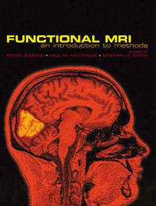 Functional Magnetic Resonance Imaging