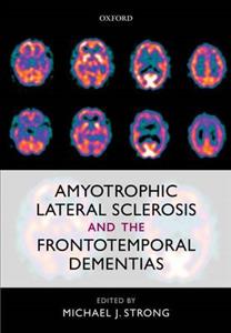 Amyotrophic Lateral Sclerosis and the Frontotemporal Dementias