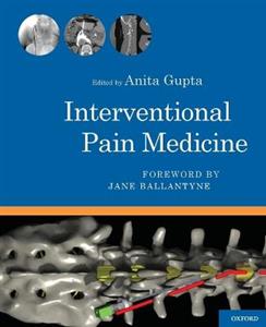 Interventional Pain Medicine