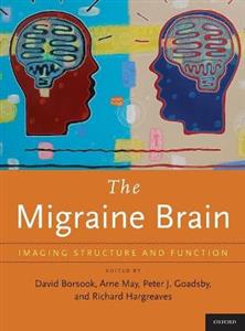 Migraine Brain: Imaging Structure and Function