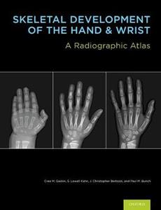 Skeletal Development of the Hand and Wrist: A Radiographic Atlas and Digital Bone Age Companion