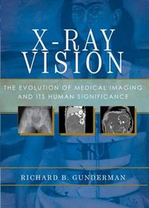 X Ray Vision