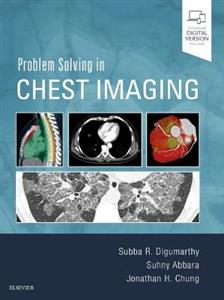 Problem Solving in Chest Imaging 1e