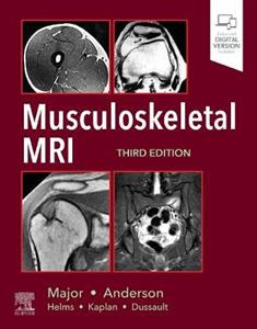 Musculoskeletal MRI 3E