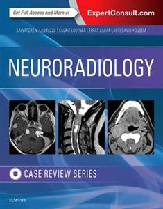 Neuroradiology Imaging Case Review