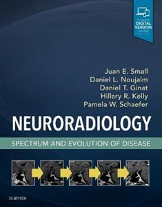 Neuroradiology: Spectrum of Disease Appr