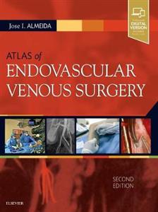 Atlas of Endovascular Venous Surgery 2e