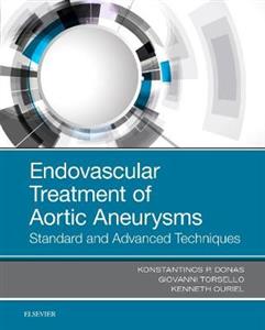 Endovascular Treatment of Aortic Aneurysms: Standard and Advanced Techniques