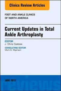 Current Updates in Total Ankle Arthropla