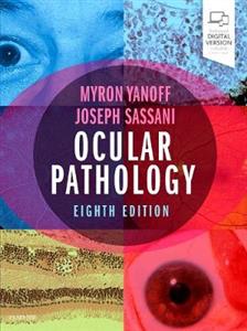 Ocular Pathology 8E