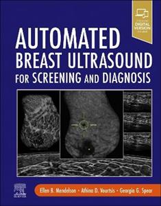 Automated Breast Ultrasound for Screening and Diagnosis