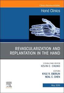 Revascularization amp; Replantation in Hand