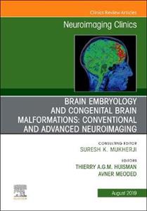 Brain Embryo amp; Cause Congenital Malform