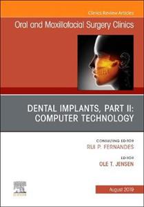 Dental Implants, Part II: Computer Tech