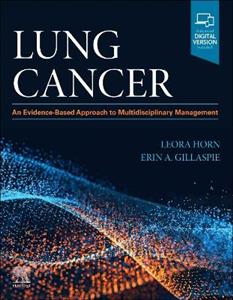 Lung Cancer: An Evidence-Based Approach to Multidisciplinary Management