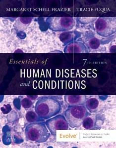 Essen of Human Diseases amp; Condition 7E
