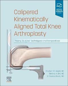 Kinematic Knee Alignment