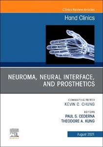 Neuroma,Neural interface,amp; Prosthetics