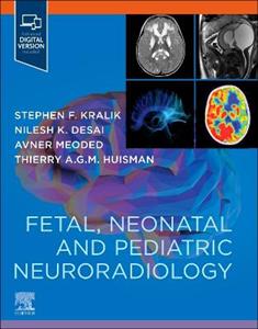 Fetal and Pediatric Neuroradiology