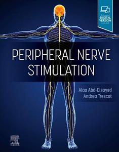 Peripheral Nerve Stimulation