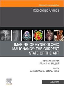 Imaging of Gynecologic Malignancy