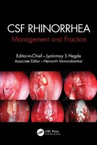 CSF Rhinorrhoea