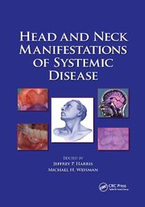 Head and Neck Manifestations of Systemic Disease