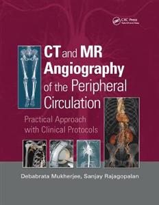 CT and MR Angiography of the Peripheral Circulation