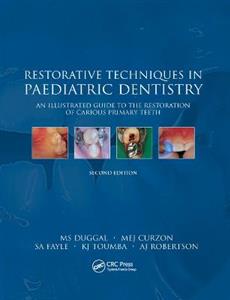 Restorative Techniques in Paediatric Dentistry