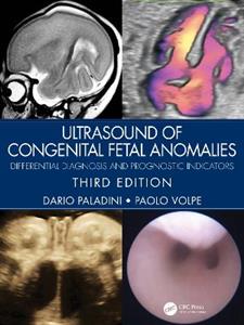 Ultrasound of Congenital Fetal Anomalies: Differential Diagnosis and Prognostic Indicators