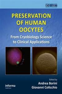 Preservation of Human Oocytes