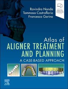 (image for) Atlas of Aligner Treatment and Planning: A Case-Based Approach