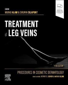 Procedures in Cosmetic Dermatology Series: Treatment of Leg Veins
