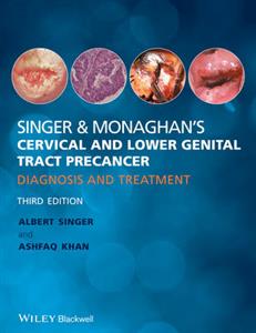 Singer and Monaghan's Cervical and Lower Genital Tract Precancer: Diagnosis and Treatment