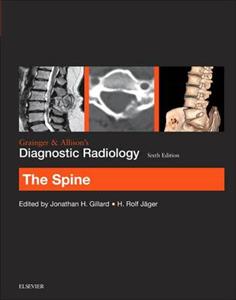 Grainger & Allison's Diagnostic Radiology: The Spine